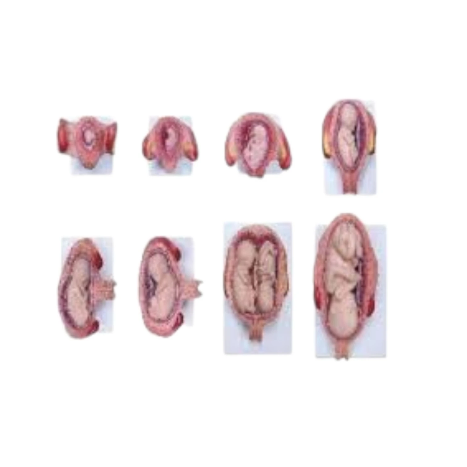 Fetal Development Model set of 8