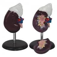 Human Kidney