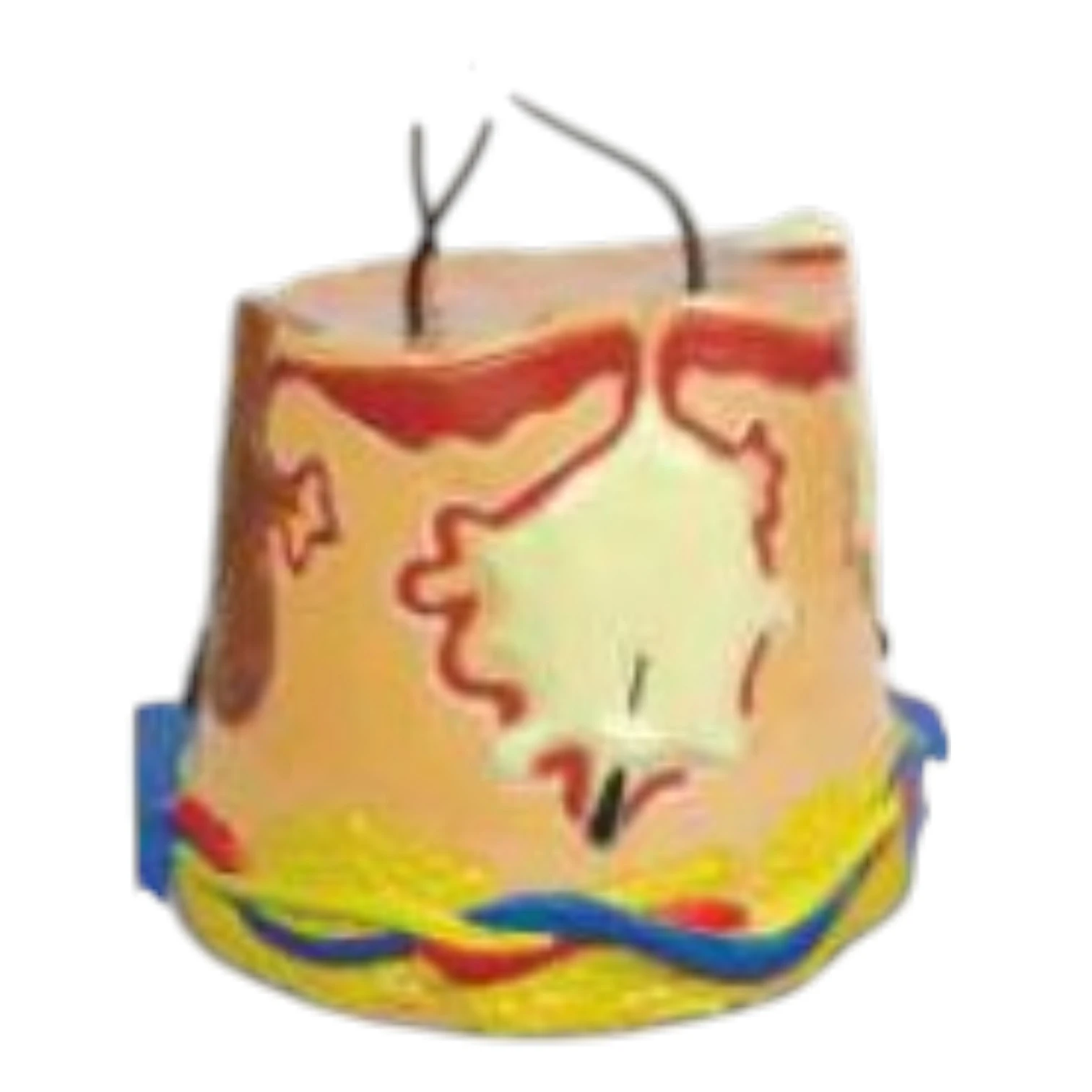 Skin Acne Anatomy Model
