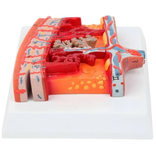 Enlarged Placenta Model