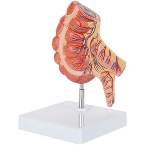 Appendix and Caecum
