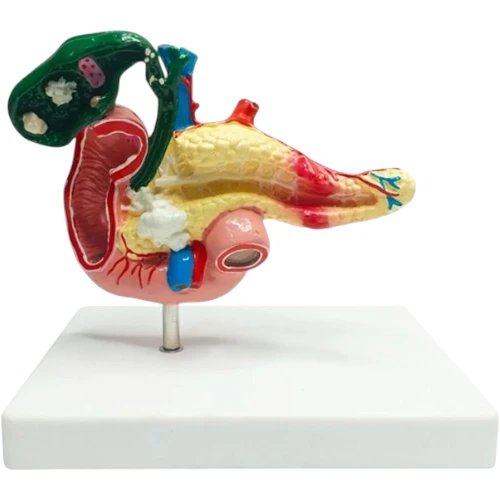 Pancreatic Region Pathology Model