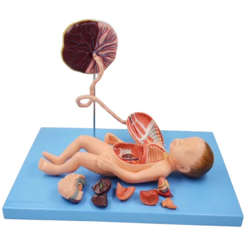 Fetus with Viscera and Placenta